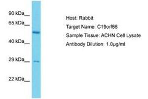 Image no. 1 for anti-Chromosome 19 Open Reading Frame 66 (C19ORF66) (AA 35-84) antibody (ABIN6750629) (C19ORF66 Antikörper  (AA 35-84))