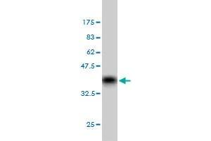 Western Blot detection against Immunogen (36. (GRK6 Antikörper  (AA 71-170))