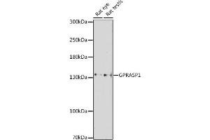 Western blot analysis of extracts of various cell lines, using GPR antibody (ABIN7267314) at 1:1000 dilution. (GPRASP1 Antikörper  (AA 200-500))