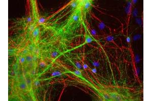 Mixed neuron and glia cultures stained with ABIN1580433 (green), and RPCA- NF-H rabbit antibody to neurofilament NF-H (red) and DNA (blue). (MAP2 Antikörper)