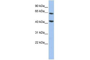 WB Suggested Anti-FOXJ3 Antibody Titration:  0. (FOXJ3 Antikörper  (Middle Region))