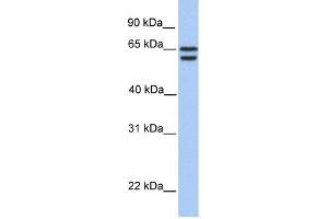 CDYL2 antibody used at 1 ug/ml to detect target protein. (CDYL2 Antikörper  (N-Term))