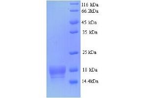 SDS-PAGE (SDS) image for ATP Synthase gamma Chain 1 (ATPC1) (AA 23-168) protein (His tag) (ABIN5713270) (ATPC1 Protein (AA 23-168) (His tag))
