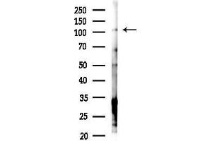 anti-Zinc Finger Protein 295 (ZNF295) (N-Term) antibody