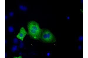 Image no. 11 for anti-Transforming, Acidic Coiled-Coil Containing Protein 3 (TACC3) antibody (ABIN1498097) (TACC3 Antikörper)