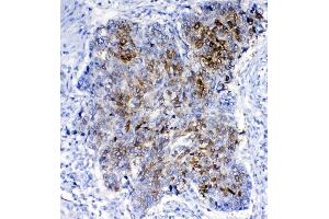 IHC analysis of GSTA1/A2/A3/A4/A5 using anti-GSTA1/A2/A3/A4/A5 antibody (ABIN5518995).