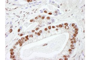 Immunohistochemistry (IHC) image for anti-Protein Kinase, DNA-Activated, Catalytic Polypeptide (PRKDC) (AA 2100-2150) antibody (ABIN7448533) (PRKDC Antikörper  (AA 2100-2150))
