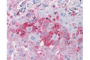 Immunohistochemical (Formalin/PFA-fixed paraffin-embedded sections) staining in human liver with DUSP26 polyclonal antibody . (DUSP26 Antikörper)