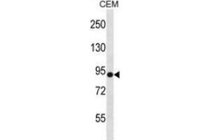 Western blot analysis in CEM cell line lysates (35ug/lane) using Neuroligin Y Antibody (N-term). (Neuroligin Y Antikörper  (N-Term))