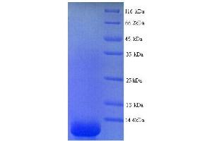SDS-PAGE (SDS) image for Dermcidin (DCD) (AA 20-110) protein (His tag) (ABIN5713396) (Dermcidin Protein (DCD) (AA 20-110) (His tag))