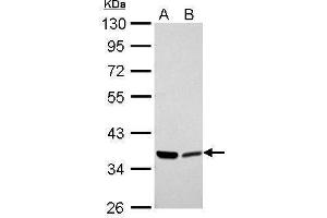 WB Image Annexin II antibody detects ANXA2 protein by Western blot analysis. (Annexin A2 Antikörper)