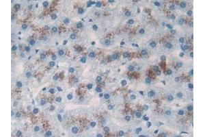 Immunohistochemistry (IHC) image for anti-TP53 Target 5 (TP53TG5) (AA 190-262) antibody (ABIN7444691)