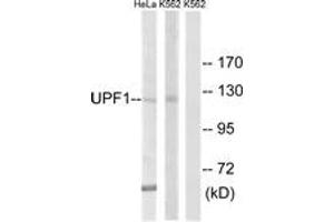 Western blot analysis of extracts from K562/HeLa cells, using UPF1 Antibody. (RENT1/UPF1 Antikörper  (AA 299-348))