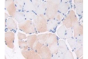 Detection of THBS1 in Mouse Skeletal muscle Tissue using Polyclonal Antibody to Thrombospondin 1 (THBS1) (Thrombospondin 1 Antikörper  (AA 515-671))