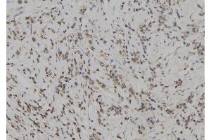 ABIN6272929 at 1/100 staining Human gastric tissue by IHC-P. (SKAP2 Antikörper  (C-Term))