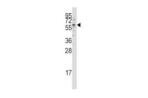 Western blot analysis of anti-HTATIP Pab (ABIN387933 and ABIN2844453) in Jurkat cell line lysates (35 μg/lane). (KAT5 Antikörper  (N-Term))