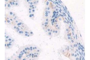 IHC-P analysis of Mouse Oviduct Tissue, with DAB staining. (WISP1 Antikörper  (AA 213-350))