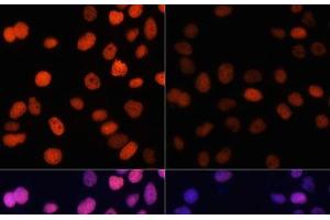 Immunofluorescence analysis of HeLa cells using Acetyl-Histone H4-K91 Polyclonal Antibody at dilution of 1:100. (Histone H4 Antikörper  (acLys91))