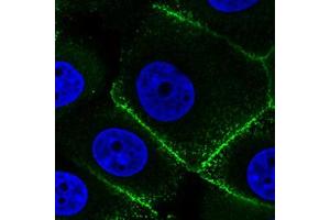 Immunofluorescent staining of MCF7 cells with EZR monoclonal antibody, clone CL2384  (Green) shows specific plasma membrane. (Ezrin Antikörper)