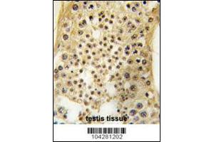 Formalin-fixed and paraffin-embedded human testis tissue reacted with USP7 antibody , which was peroxidase-conjugated to the secondary antibody, followed by DAB staining. (USP7 Antikörper  (C-Term))