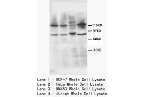 Western blot with TNFR2 Polyclonal Antibody (TNFRSF1B Antikörper  (N-Term))