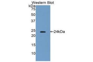 Western Blotting (WB) image for anti-Interferon, beta 1, Fibroblast (IFNB1) (AA 22-186) antibody (ABIN3209030) (IFNB1 Antikörper  (AA 22-186))