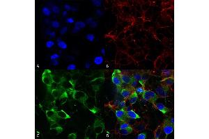 Immunocytochemistry/Immunofluorescence analysis using Mouse Anti-Slo2. (KCNT1 Antikörper  (AA 1168-1237) (PE))