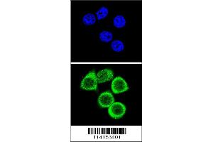 Confocal immunofluorescent analysis of PARP1 Antibody with Hela cell followed by Alexa Fluor 488-conjugated goat anti-rabbit lgG (green). (PARP1 Antikörper  (N-Term))
