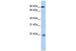 Image no. 1 for anti-Nuclear Factor of Activated T-Cells, Cytoplasmic, Calcineurin-Dependent 1 (NFATC1) (N-Term) antibody (ABIN6742798) (NFATC1 Antikörper  (N-Term))