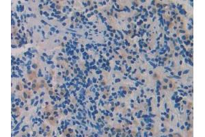 Used in DAB staining on fromalin fixed paraffin- embedded adrenal gland tissue (ADAMTS1 Antikörper  (AA 854-967))