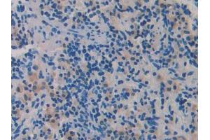Immunohistochemistry (IHC) image for anti-ADAM Metallopeptidase with Thrombospondin Type 1 Motif, 1 (ADAMTS1) (AA 854-967) antibody (ABIN1857898)