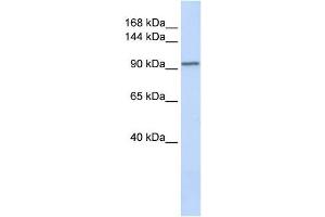 PAM antibody used at 1 ug/ml to detect target protein.