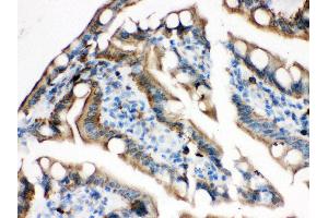Anti- Plectin Picoband antibody, IHC(P) IHC(P): Rat Intestine Tissue (PLEC Antikörper  (Middle Region))
