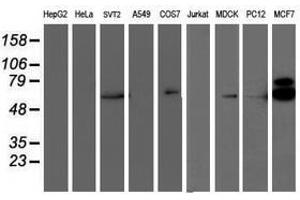 Image no. 3 for anti-Ribosomal Protein S6 Kinase, 70kDa, Polypeptide 1 (RPS6KB1) antibody (ABIN1500001) (RPS6KB1 Antikörper)