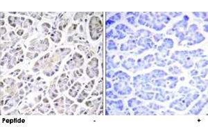 Immunohistochemistry analysis of paraffin-embedded human pancreas tissue using ATP5G3 polyclonal antibody . (ATP5G3 Antikörper)