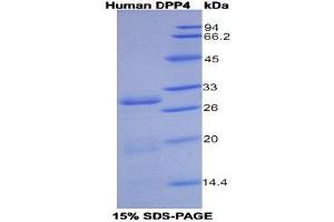 SDS-PAGE (SDS) image for Dipeptidyl-Peptidase 4 (DPP4) protein (His tag) (ABIN1099045) (DPP4 Protein (His tag))