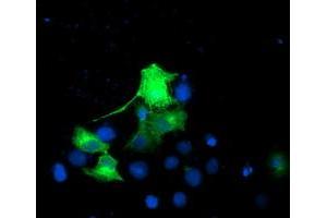 Anti-EPN2 mouse monoclonal antibody (ABIN2455557) immunofluorescent staining of COS7 cells transiently transfected by pCMV6-ENTRY EPN2 (RC213652). (Epsin 2 Antikörper)