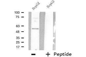 AGXT2L2 Antikörper  (C-Term)