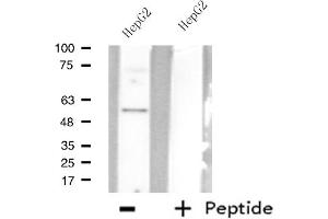 Western blot analysis of extracts from HepG2 cells using AGXT2L2 antibody. (AGXT2L2 Antikörper  (C-Term))