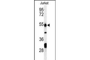 Western blot analysis of PRUNE Antibody (C-term) (ABIN653704 and ABIN2843021) in Jurkat cell line lysates (35 μg/lane). (PRUNE Antikörper  (C-Term))