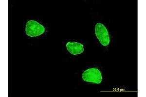 Immunofluorescence of monoclonal antibody to MEF2BNB on HeLa cell . (MEF2BNB Antikörper  (AA 1-109))