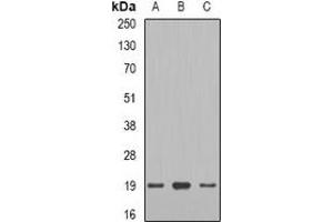 Western blot analysis of Telethonin expression in mouse heart (A), rat heart (B), rat skeletal muscle (C) whole cell lysates.