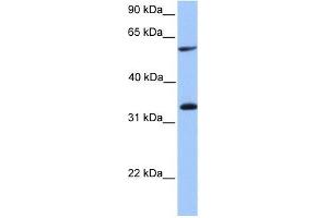 TSKS antibody used at 1 ug/ml to detect target protein. (TSKS Antikörper  (Middle Region))