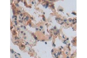Used in DAB staining on fromalin fixed paraffin- embedded lung tissue (DDC Antikörper  (AA 200-420))