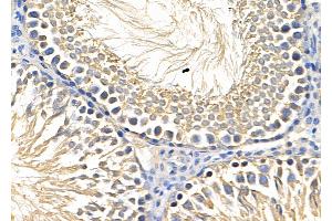 ABIN6259806 and ABIN6278707 at 1/100 staining Rat testis tissue by IHC-P.