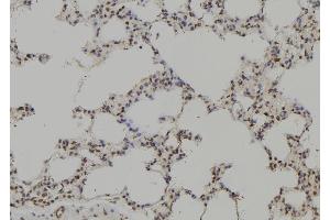 ABIN6269204 at 1/100 staining Rat lung tissue by IHC-P. (SHP1 Antikörper  (C-Term))