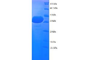 SDS-PAGE (SDS) image for H3 Histone, Family 3A (H3F3A) (AA 2-136), (full length) protein (GST tag) (ABIN1607971)