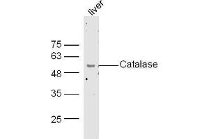 Mouse liver lysates probed with Rabbit Anti-Catalase Polyclonal Antibody, Unconjugated  at 1:500 for 90 min at 37˚C.
