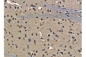 ABIN6263498 and ABIN6268752 at 1/100 staining rat brain tissue by IHC-P. (MYCN Antikörper  (Internal Region))