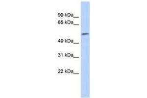 Image no. 1 for anti-SRY (Sex Determining Region Y)-Box 11 (SOX11) (AA 251-300) antibody (ABIN6742368) (SOX11 Antikörper  (AA 251-300))